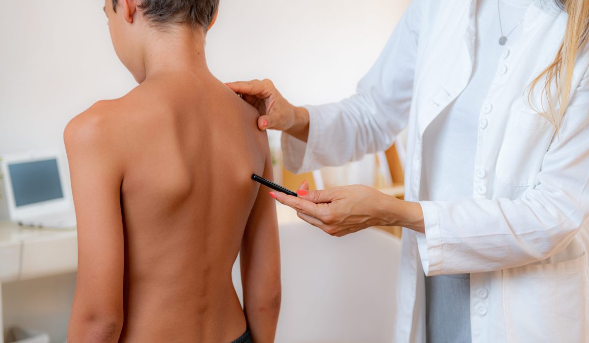 Pediatric doctor examining posture of a boy, making marks on his back, checking angle of scapula bones.